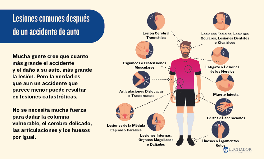 Lesiones comunes después de un accidente de auto